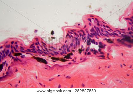 Amphibian Skin With Ulcer Under A Microscope