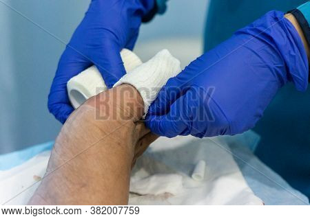 Healthcare Worker Nursing Toe With Bandage Gauz After Ingrown Toenail Surgery