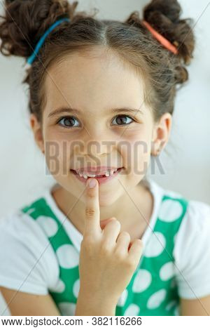 Little Girl With No Tooth. The Child Lost A Tooth. High Quality Photo.