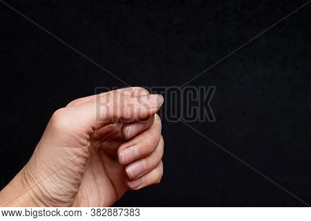 Close-up Of A Human Hand With Nails, Overgrown Cuticles, Flaky Layer And Nail, Bad Manicure On Black