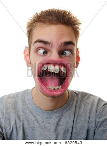 Hombre con boca raro