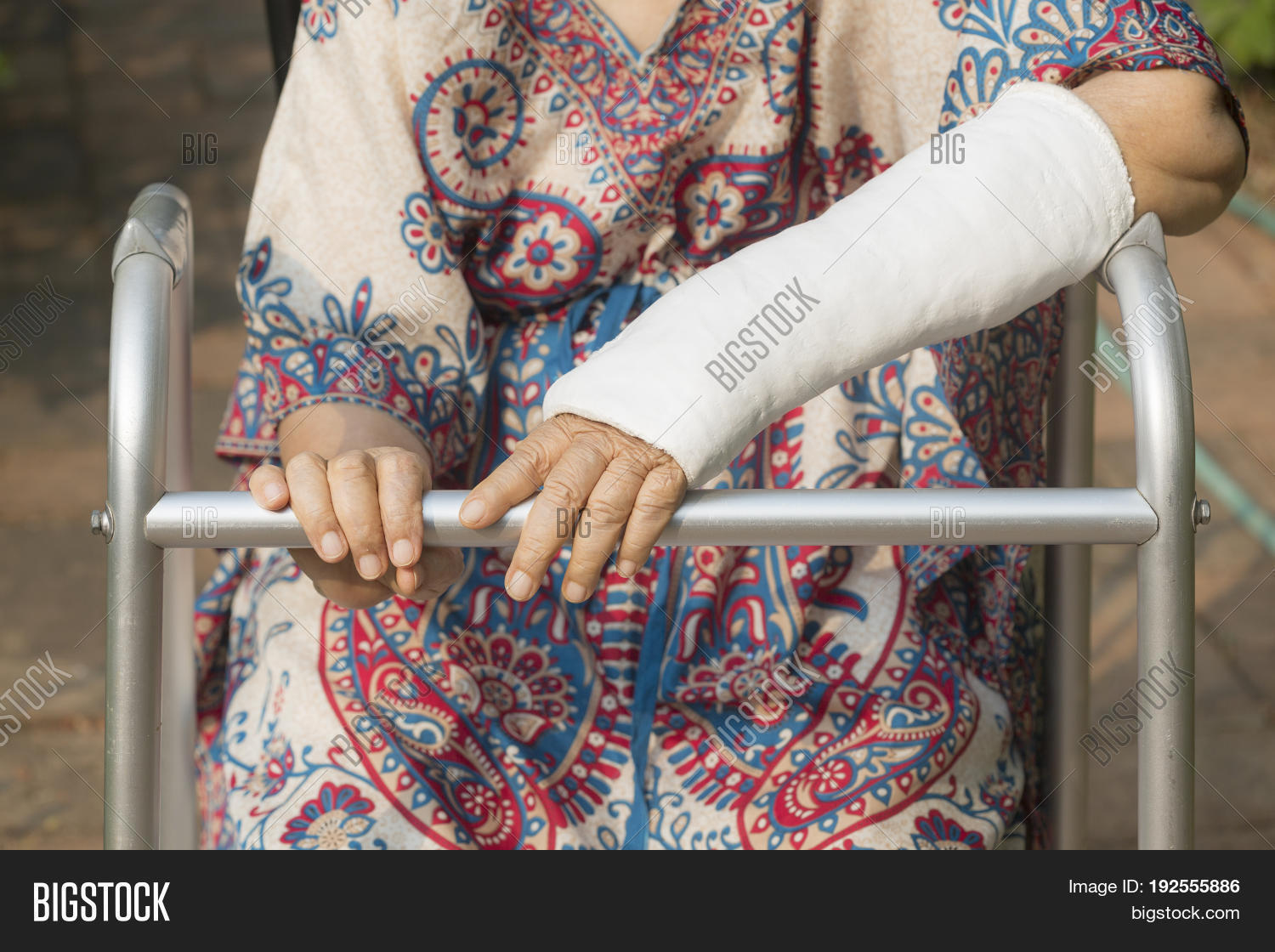 пожилая женщина с поломанной ногой фото. фото пожилой женщины и перелом руки. бабушка просит милостыню. старушка попрошайка. бабушке сломали руку.