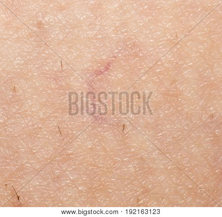 veins on the skin. close . A photo
