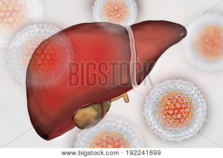 Liver with Hepatitis C infection surrounded by Hepatitis C Viruses HCV, 3D illustration