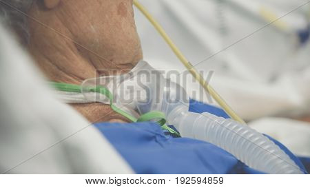 Patient Do Tracheostomy And Ventilator In Hospital