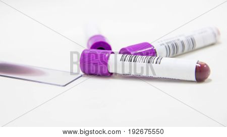 Tube CBC test laboratory on white background.