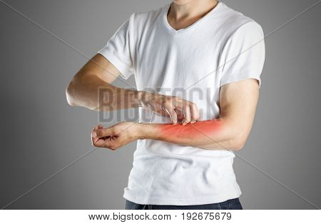 Guy In White Shirt Scratching His Arm. Scabies. Scratch The Hand. Isolated