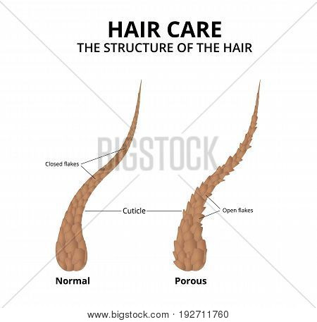 The structure of the hair, the cuticle of a healthy and damaged human hair.