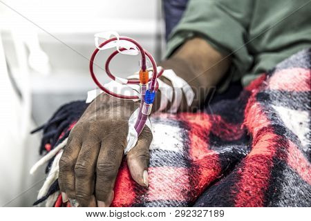 Hemodialysis In People On The Equipment