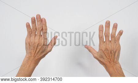 Senior Or Older Woman Hand That Had Arthritis Or Trigger Fingers On White Background.