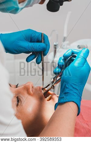 Installation Of A Rubber Dam With A Metal Clamp For Dental Fillings, Sterile And Modern Dental Treat