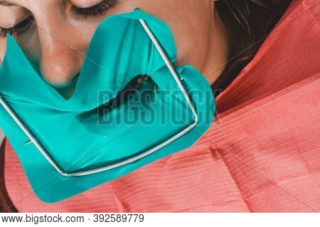 Installation Of A Cofferdam To The Patient, Modern Dental Equipment, Treatment In Sterile Conditions