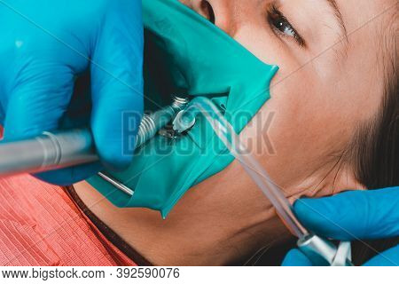 Dentist Treats The Tooth With Modern Methods, Uses A Rubber Dam, Sterile Tooth Treatment.