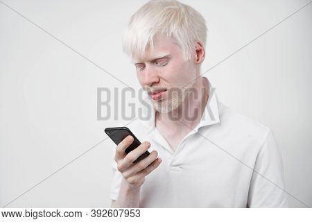 Albinism Albino Man White Skin Hair Studio Dressed T-shirt Isolated White Background Abnormal Deviat