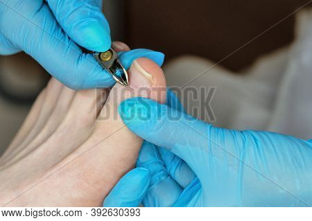 Master Chiropody Removes The Cuticle. Cuticle Treatment Is One Of The Stages Of Processing The Cutic