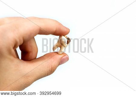A Close Up Of A Broken Tooth On An Isolated White Background. The Cause Of Toothache. A Bad Tooth. H