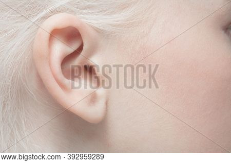 Ear. Close Up Portrait Of Beautiful Albino Female Model. Parts Of Face And Body. Beauty, Fashion, Sk