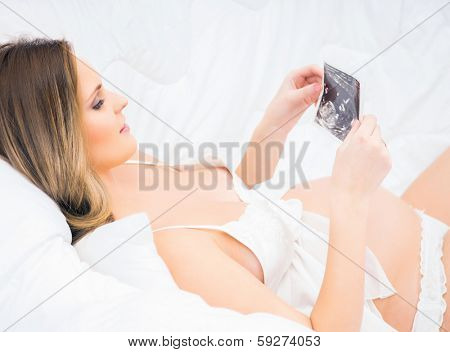 A young and pregnant woman relaxing in the bed and holding an ultrasound