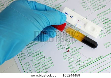 HIV testing negative