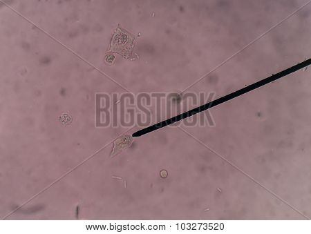 Renal Epithelial Cells In Urine.