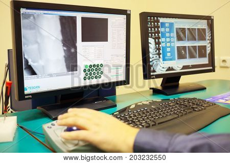 MOSCOW - SEP 22, 2016: Hand of man working and hair under microscope on screen of computer in Forensic Center at Petrovka, 38, Main Department of Moscow Ministry of Internal Affairs