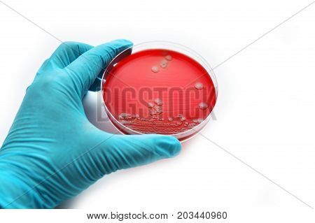 Colonies of bacteria in petri dish, white background