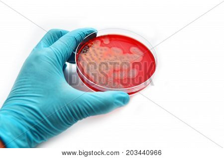 Colonies of bacteria in petri dish, white background