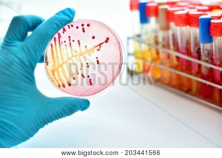 Colonies of bacteria in petri dish (MacConkey agar)