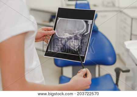 A Female Dentist Holds An X-ray Photo Of A Human Skull From A Profile In The Dental Office