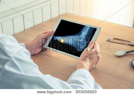 Doctor Holding A Digital Tablet With X-ray Of Pain Under The Foot