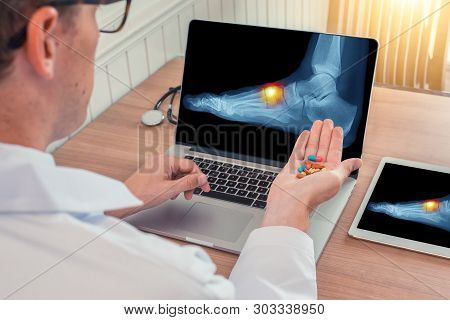 Doctor Holding Pills With X-ray Of A Foot With Pain On The Top On A Laptop. Digital Tablet On The De