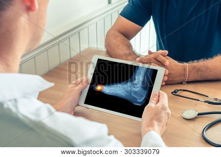 Doctor Holding A Digital Tablet With X-ray Of Foot Of The Patient. Pain In The Toe