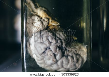 Reserved Animal Brain In Liquid Formaldehyde In Glass Jar In Scientific Veterinary Laboratory, Close