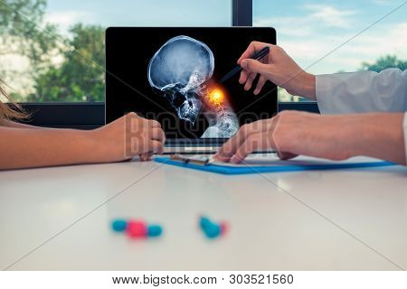 Doctor Showing A X-ray Of Skull With Pain In The Neck On A Laptop To A Woman Patient. Headache Migra