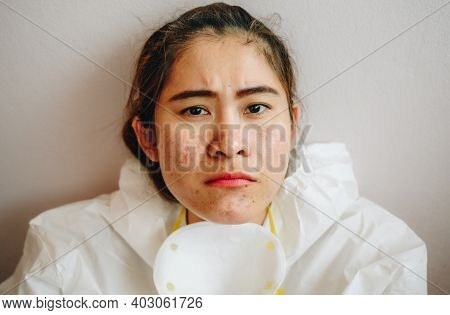 Healthcare Worker With Acne And Facial Wounds Occur From A Medical Mask After Work For A Longtime In