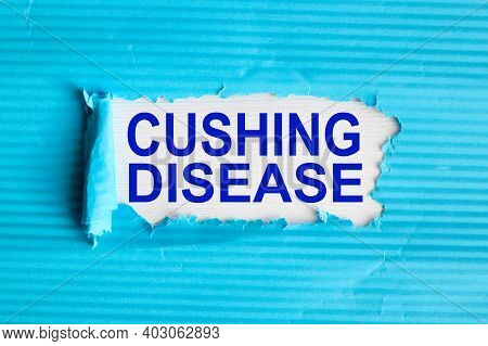 Cushing Disease, Text On White Paper Against Torn Blue Paper Background Medical Concept.