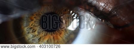 Close-up Of Green-brown Pupil Contracting And Expanding. Good Vision. Contact Lenses. Eye Health And