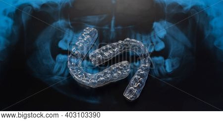 Transparent Bite Correction Trays And X-ray Of The Jaw. Orthodontist Equipment