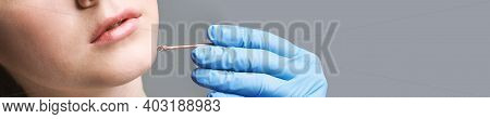 Loop Device Medical Image & Photo (Free Trial) | Bigstock