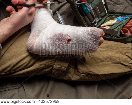 Leg Bandage. Stopping Bleeding With A Bandage. First Aid
