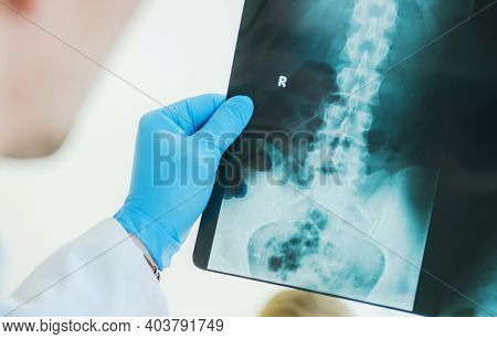 Hospital Radiologist Examining X Ray Image Of His Patients Lower Spine Area. Radiography And Health 