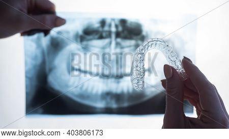 Female Hands With Transparent Mouth Guards For Correcting Bite And X-ray Of The Jaw. The Orthodontis