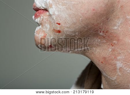 Man's face chin with blood after shaving. Man in bath in the morning with shaving gel and wounds on his face. Man with towel in front of mirror shaves his beard
