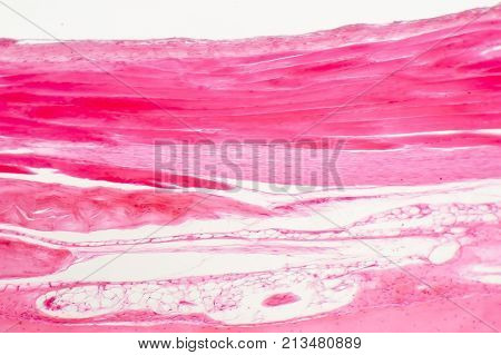 Dense regular connective tissue, light photomicrograph, upper part of the photo