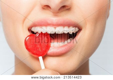 Close-up portrait of woman with orthodontic clear brackets biting off red lollipop in the shape of heart