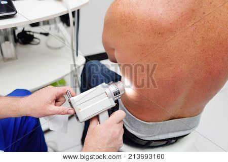 The dermatologist examines the moles or acne of the patient with a dermatoscope. Prevention of melanoma