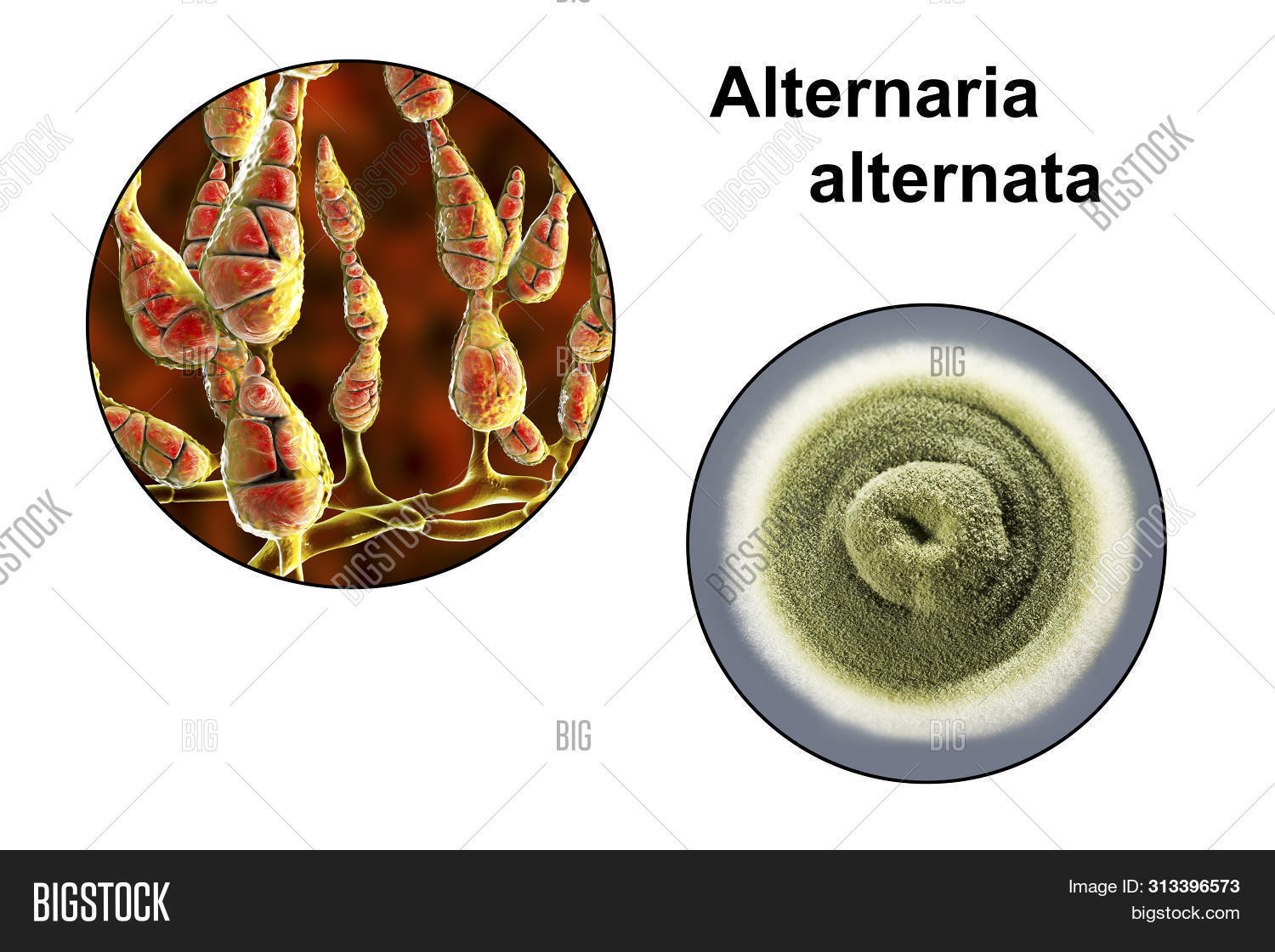 Mold Alternaria Image & Photo (Free Trial) | Bigstock