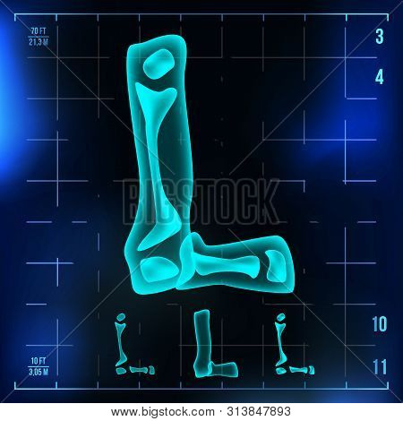 L Letter . Capital Digit. Roentgen X-ray Font Light Sign. Medical Radiology Neon Scan Effect. Alphab