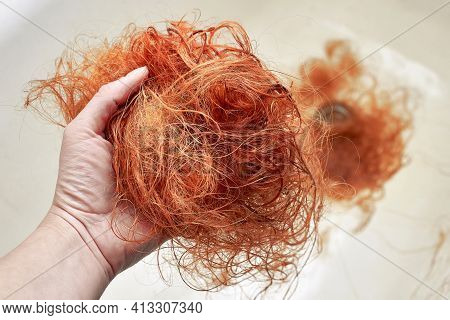 A Large Amount Of Fallen Hair In A Woman's Hand. Severe Hair Loss In A Serious Illness. Close-up