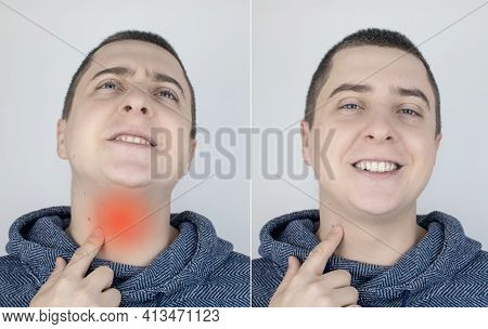 Before And After. On The Left, The Man Indicates A Sore Throat, And On The Right Indicates That The